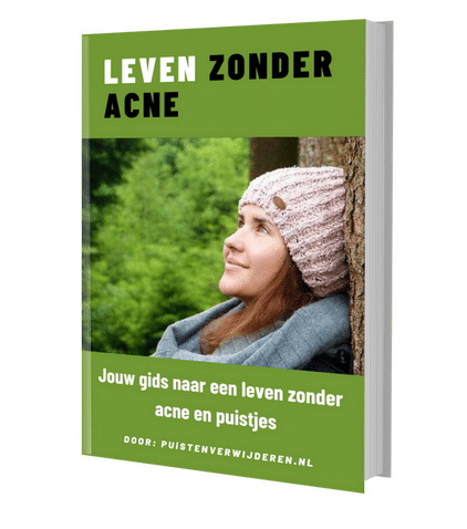 leven-zonder-acne-ebook